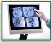 Intra-Oral Dental Camera - Latest Technology